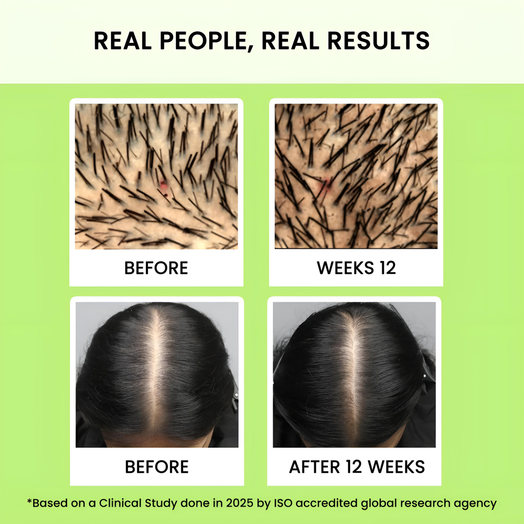 Alps Goodness Rosemary Water (100ml) Under 179 | Rosemary water for hair care | Hair Spray for Regrowth | Hair Growth Expert | Stops Hair Fall | Foorship
