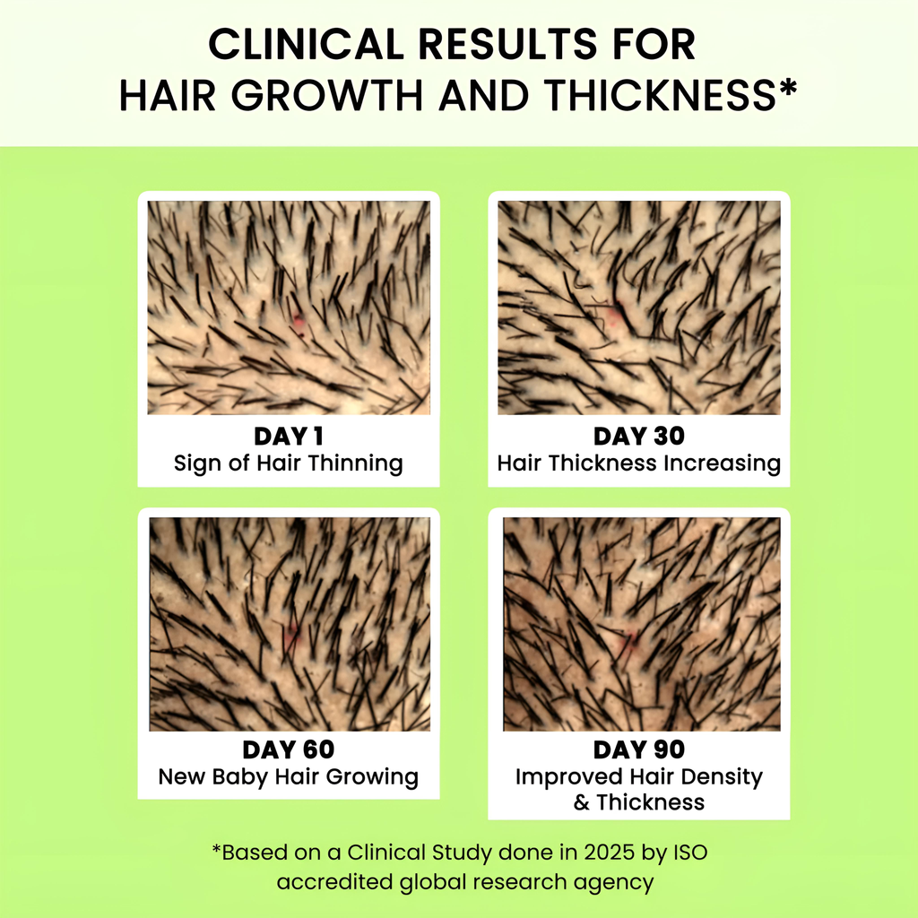 Alps Goodness Rosemary Water (100ml) Under 179 | Rosemary water for hair care | Hair Spray for Regrowth | Hair Growth Expert | Stops Hair Fall | Foorship